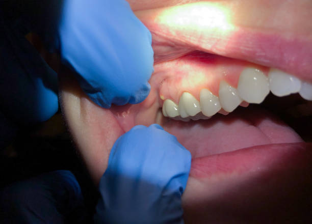 Best Tooth Infection Emergency Dentist  in Stormstown, PA